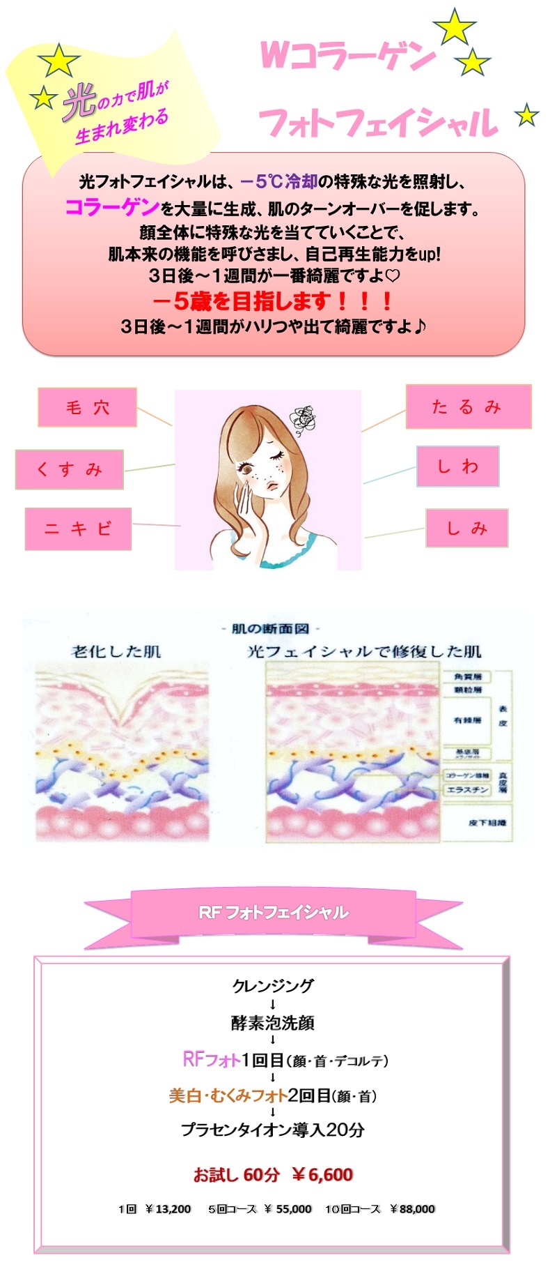 光の力で肌が生まれ変わる Wコラーゲン フォトフェイシャル