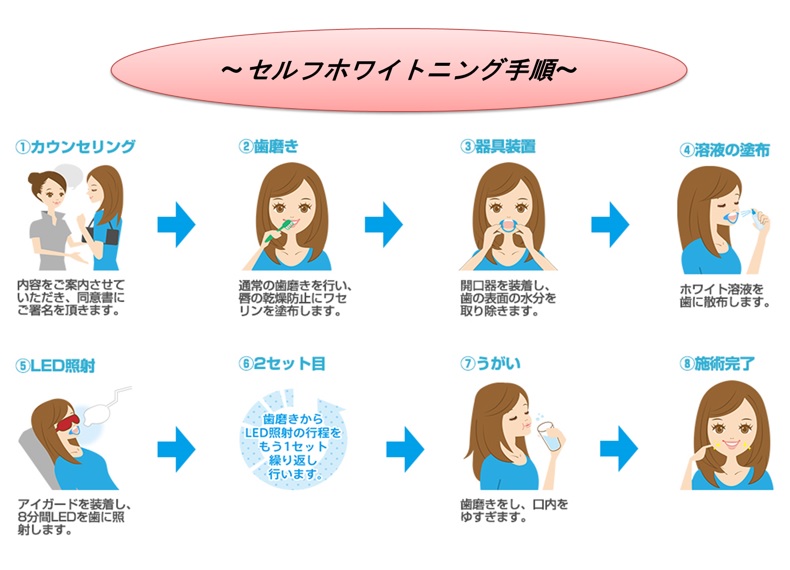 セルフホワイトニング手順